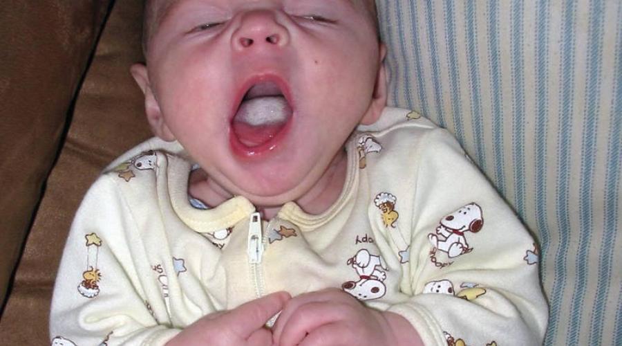Příčiny plaku u novorozenců.  Plaketa na jazyku dítěte