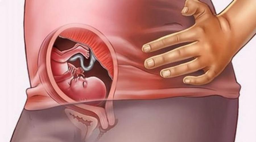 precizia cu ultrasunete fetale)